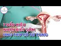 7 dấu hiệu nhận biết sớm ung thư cổ tử cung | BS Nguyễn Thị Tân Sinh, BV Vinmec Times City