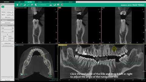 Ez3D-i | SECTION Tab | Section View & Curve Manipulation