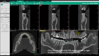 Ez3D-i | SECTION Tab | Section View & Curve Manipulation