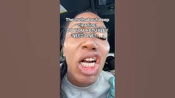 The Truth About DEEP Teeth Cleanings! 😭🦷