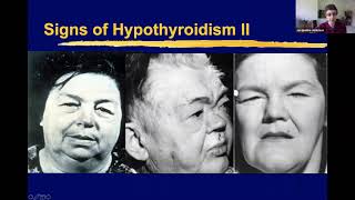 Thyroid Disorders