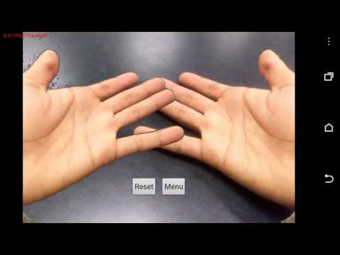 Phantom Limb Pain Therapy App