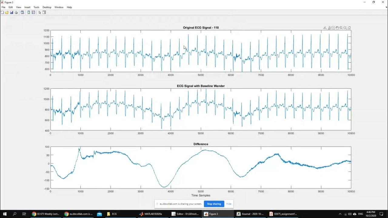 Lecture 4 Biomedical Signal Processing Course Recordings Spring 2020 YouTube
