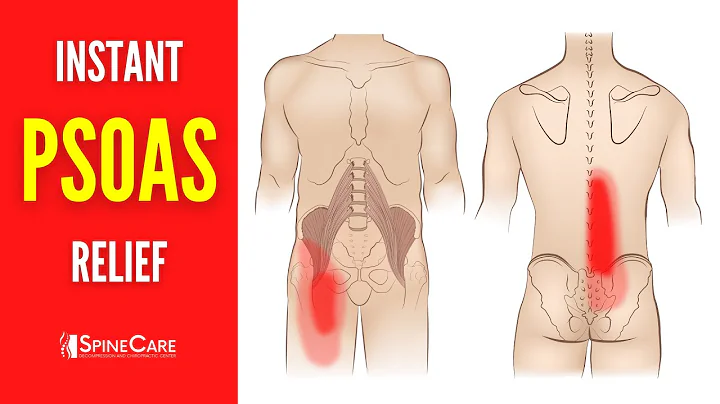 How to INSTANTLY Relieve Psoas Muscle Pain