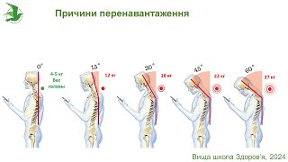 Як мати здоровий хребет та кістки. Алгоритм дій. Остеохондроз, грижі, протрузії.