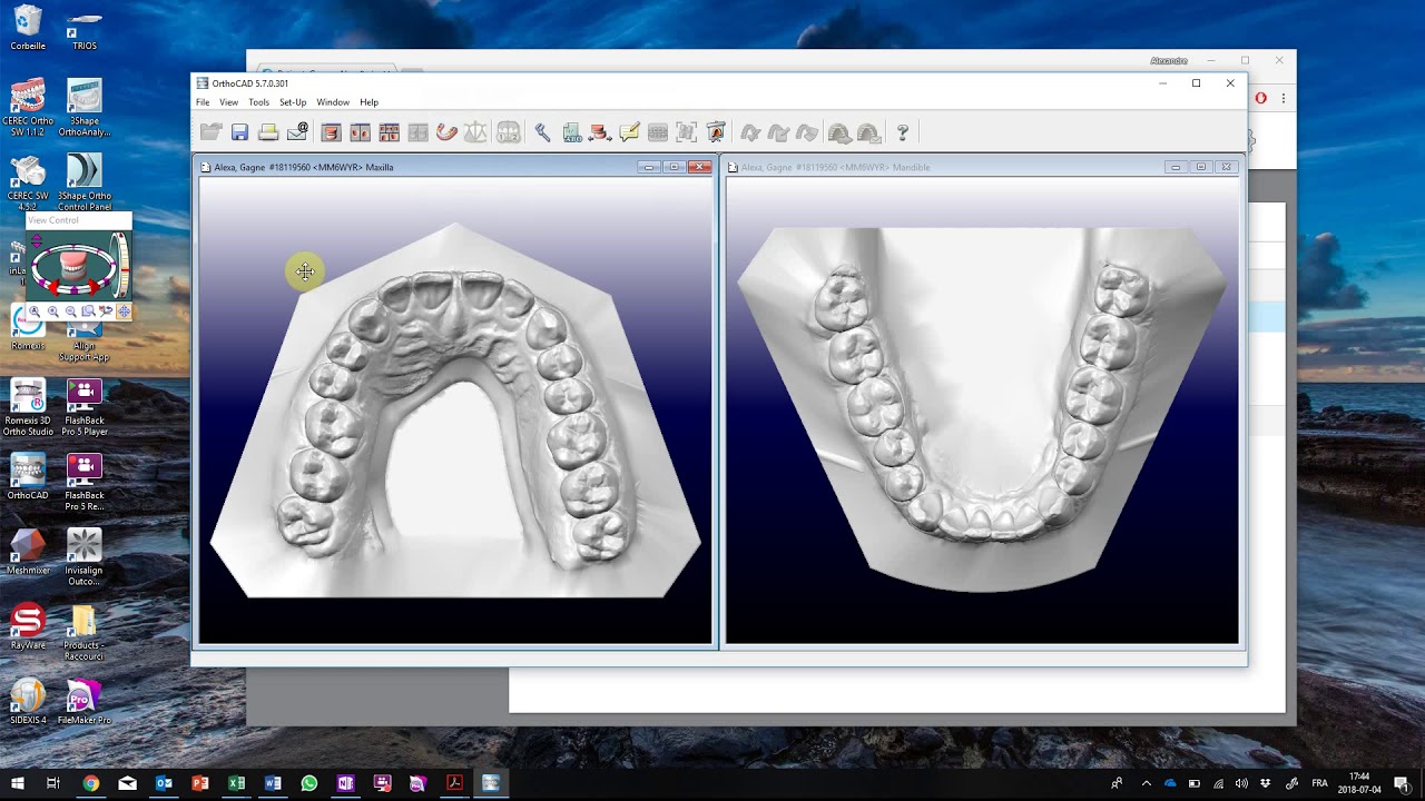 exporter images de Orthocad YouTube
