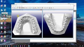 exporter images de Orthocad