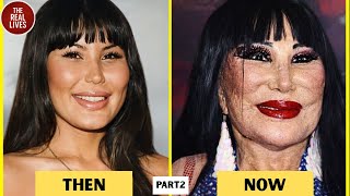 When Beauty Went Too Far: Hollywood’s Most Shocking Transformations | Part2 | Then and Now 2026
