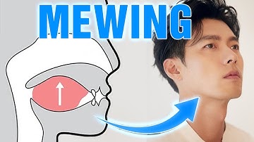 Bùng Nổ Xu Hướng Mewing: Liệu Có Cần Niềng Răng?