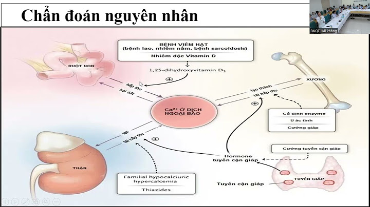 Tăng canxi máu liên quan đến ung thư là gì năm 2024