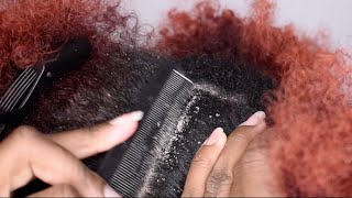 ITCHY DRY SCALP | SCRATCHING DANDRUFF | RAKING SCALP | watch the whole vid for a surprise 🙊