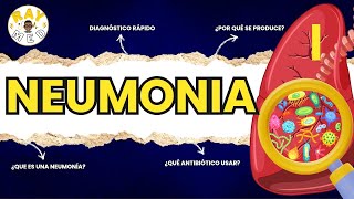 ¿Qué es la Neumonía Adquirida en la Comunidad? Te lo explico en breve!