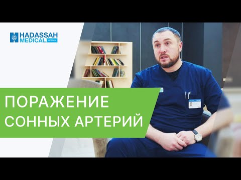 😴 Лечение атеросклероза сонных артерий - какие методы? Лечение атеросклероза сонных артерий. 12+