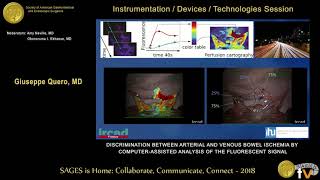 Discrimination between arterial & venous bowel ischemia by computer-assisted analysis