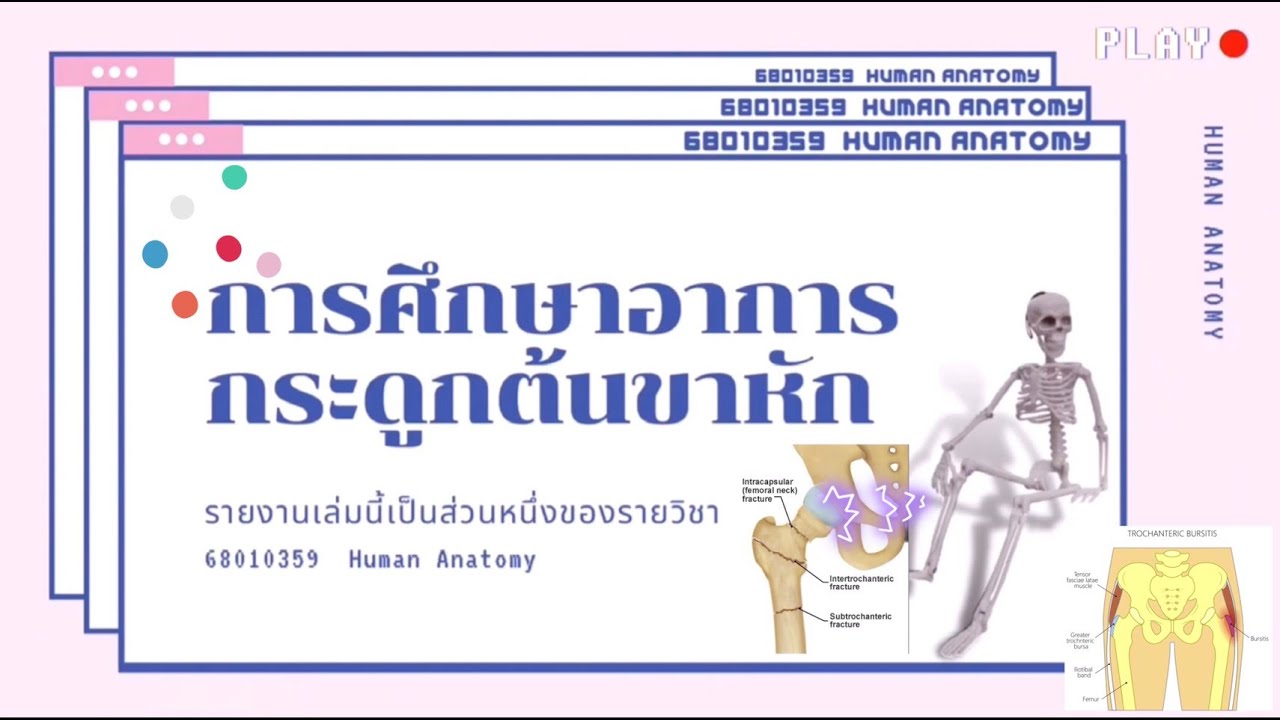 พยาธิ สภาพ กระดูก ต้น ขา หัก  New 2022  การศึกษาอาการกระดูกต้นขาหัก Femur bone fracture