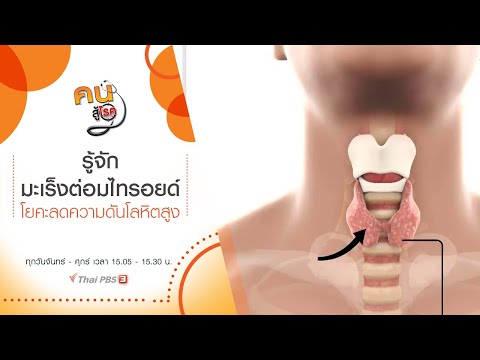 วีดีโอ: 4 วิธีในการจัดการกับการเหยียดเชื้อชาติ