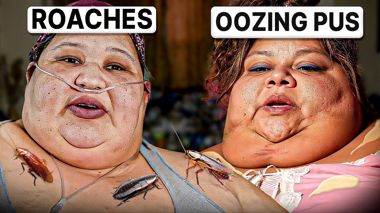 The GROSSEST Patients Ever Featured On My 600lb Life