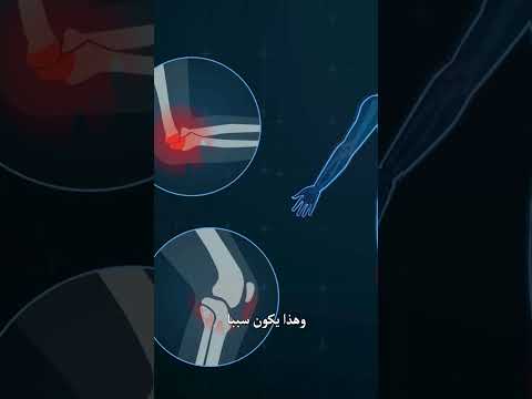 اكتشف أسرار علاجه في ألمانيا ل مفصل المرفق الصناعي الجزء الثالث  صحة المفاصل علاج