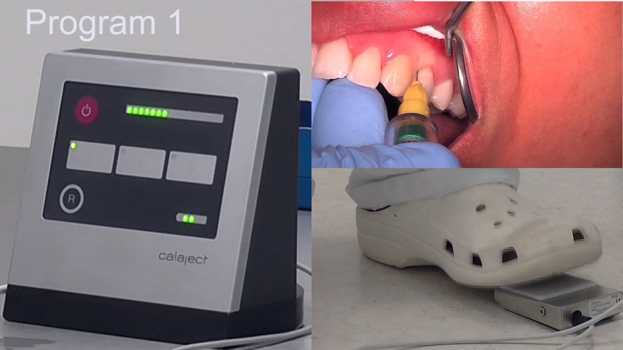 Calaject - sådan virker den