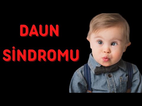 Video: Daun Sindromunun əlamətlərini tanımağın 4 yolu