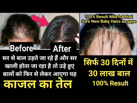 वीडियो: जुराबों से बालों को कर्ल कैसे करें (चित्रों के साथ)