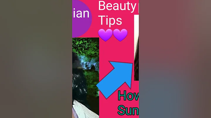Beauty  Skin Care (Sun-burn)                   ( P...
