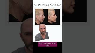 The Viral Ponytail Facelift | Dr. Matthew J. Nykiel