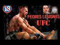 LAS PEORES LESIONES  EN UFC - MMA