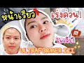 ยกหน้าเรียวเร่งด่วนแบบไม่เจ็บด้วยการทำ Ultraformer iii 300 SHOT‼️ | MAYNESSA