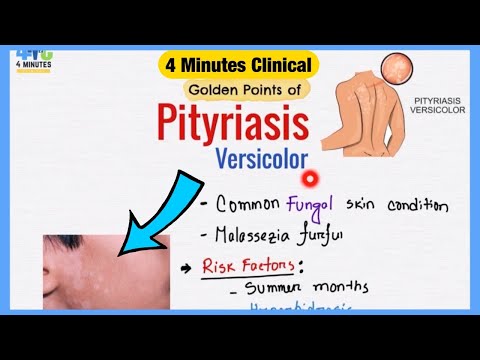 Video: Pityriasis versicolor u ľudí: čo to je a ako s ňou zaobchádzať