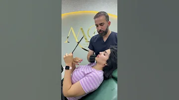 حقن الشفاه بالطريقة الروسية 