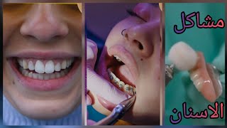 امراض الاسنان المنتشره الوقايه خير من العلاج تسوس الاسنان