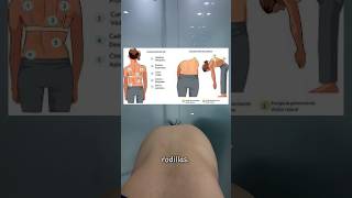 Como Saber Si Alguien Tiene Escoliosis