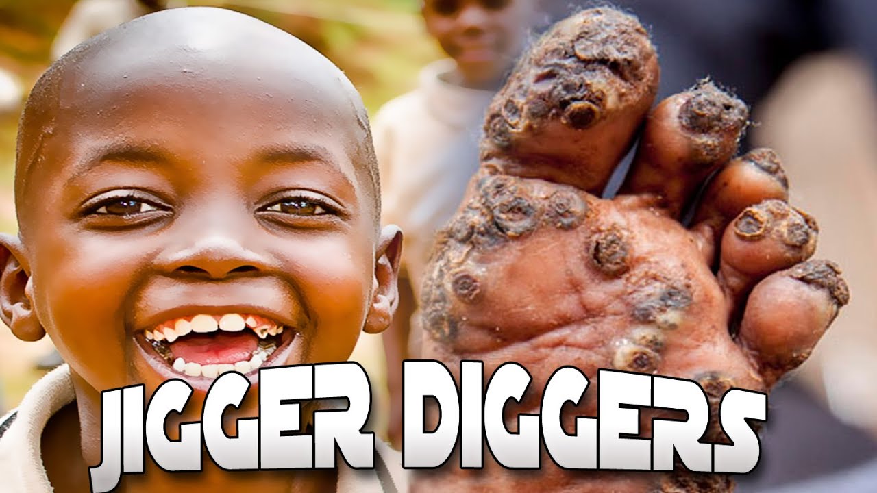 Jigger Diggers Joseph's Foot Whiteheads - YouTube