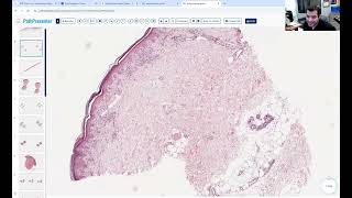 Avi Bitterman Dermpath Lecture 5 (Interface)