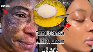 Try using Turmeric  & Lemon for clear glowing flawless Face Turmeric remove wrinkles sunburn