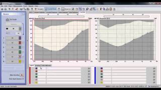 AURICAL - Tinnitus Markers in PMM