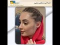 جراحی زیبایی بینی 
