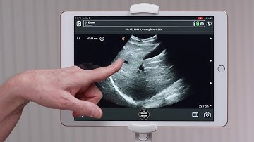 Clarius Feature: Measurements