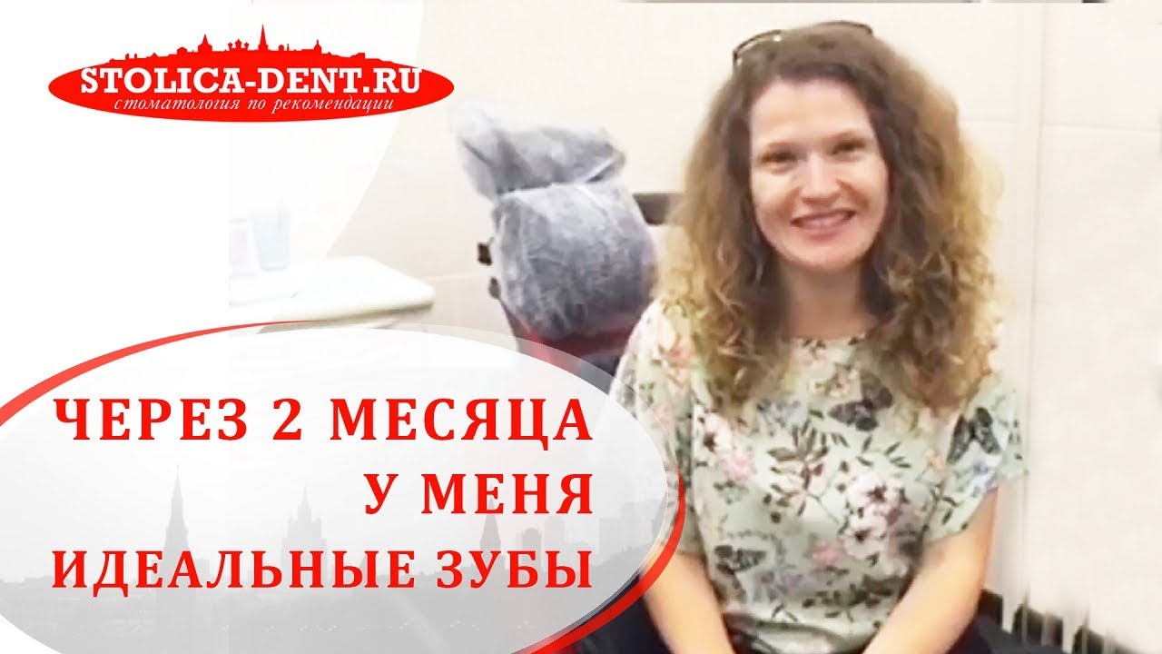 😀 Ровные зубы за 2 месяца, отзыв пациентки о ношении элайнеров. Элайнеры отзывы. Столица. 12+