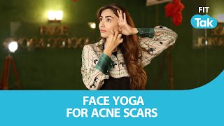 Face Yoga for acne scars | Fit Tak | Face Yoga | Skincare