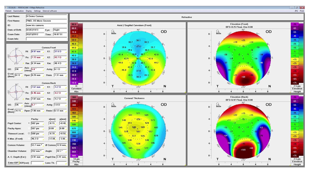 OCULUS Pentacam® AXL Demo at AAO 2017