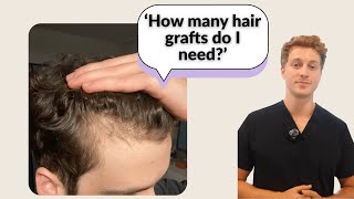 Find Out How Many Grafts You Need in 5 Minutes