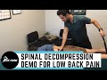 Spinal Decompression for Low Back Pain | San Diego Chiropractic