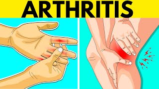 Famous How to Deal With Arthritis in Cold Weather | Does Arthritis Get Worse in Cold Weather? Wealth