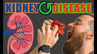 Chronic kidney disease (ckd) affects nearly 40m americans. much of the
world suffers from failure in this part their body. one biggest
stories i wa...