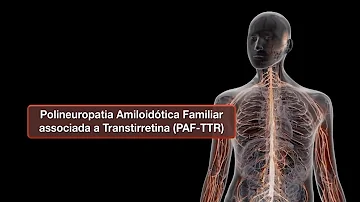 O que é uma polineuropatia?