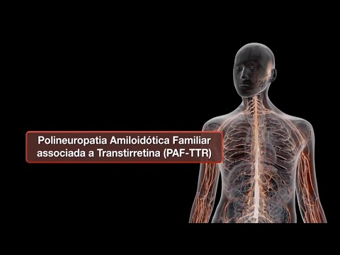 Vídeo: Micro-heterogeneidade Da Transtirretina No Soro E No Líquido Ascítico De Pacientes Com Câncer De Ovário