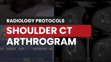 Shoulder CT Arthrogram: Protocol Guide for Radiology Techs