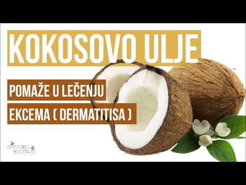 Video: Kokosovo Ulje Za Ekcem: Prednosti I Koristi